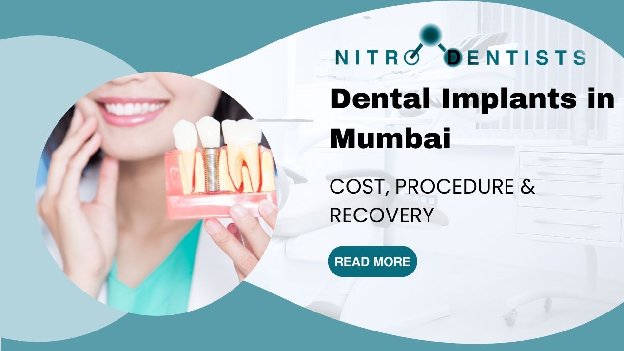 Dental Implants in Mumbai — Cost, Procedure & Recovery at Nitro Dentists
