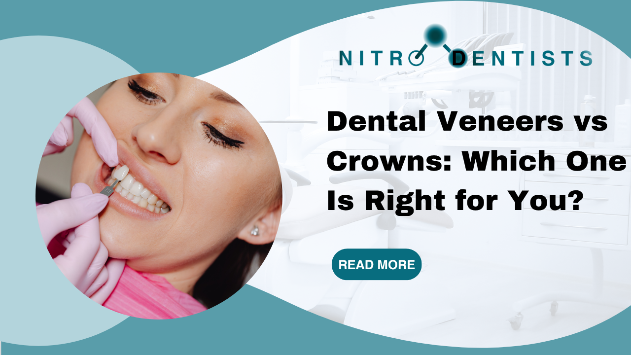 Dental Veneers vs Crowns: Which One Is Right for You