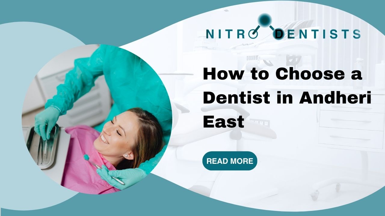 Guide to Choosing a Dentist in Andheri East Mumbai