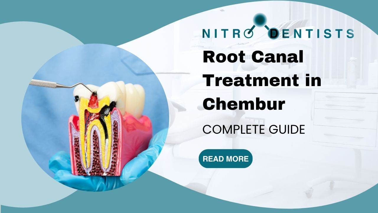 Root Canal Treatment in Chembur: Complete Guide