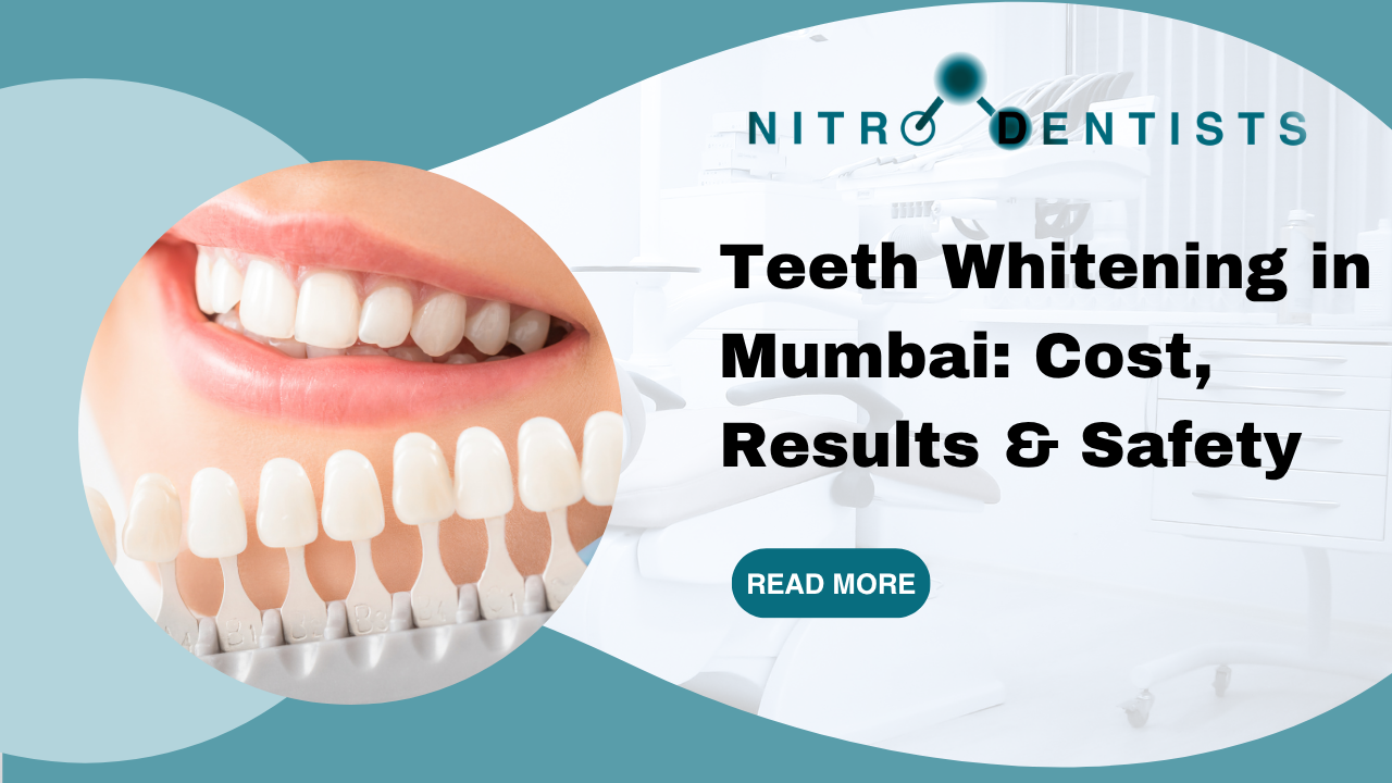 Teeth Whitening in Mumbai: Cost, Results & Safety